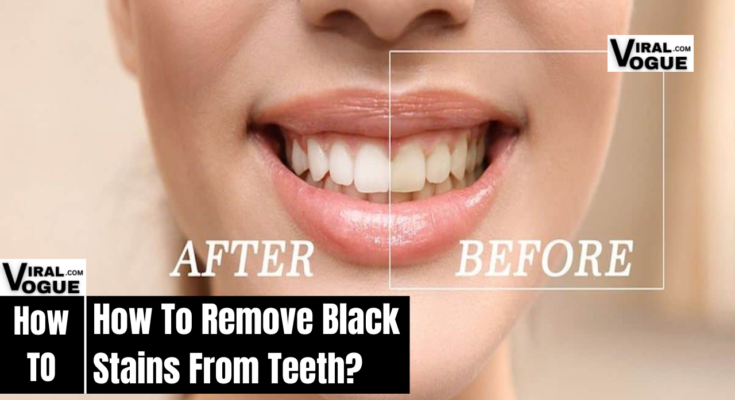 How To Remove Black Stains From Teeth